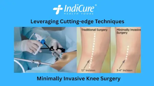 Image Minimally Invasive Surgery Latest Surgery Technique